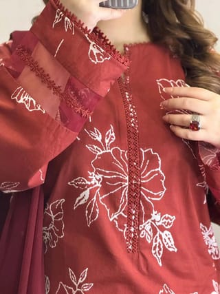 Cotton dress with skin Print 2