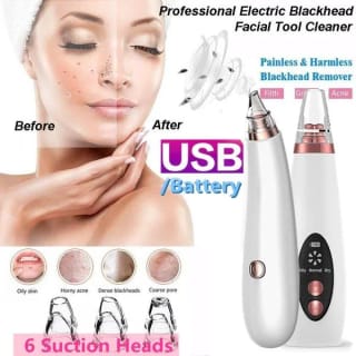 Blackhead Remover Instrument Black Dot Remover Acne Vacuum Suction Face Clean Black Head Pore Cleaning Beauty Skin Care Tool - Black Head Remover - Darma Roller 3