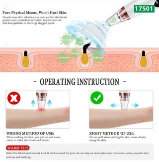 Electric Blackhead Remover Vacuum – SMRS-17501 4