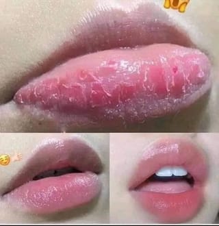 Lip balm in pink jar 1